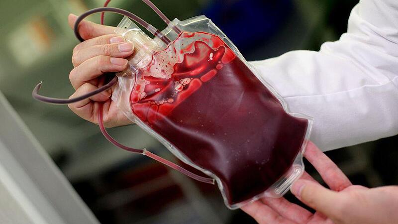 Wiener Patientin wurde in Spital durch Blutkonserve mit HIV infiziert
