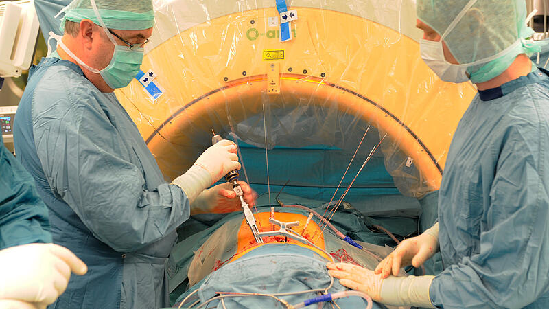 Navigieren zur Wirbelsäule erspart Patienten belastende Operationen