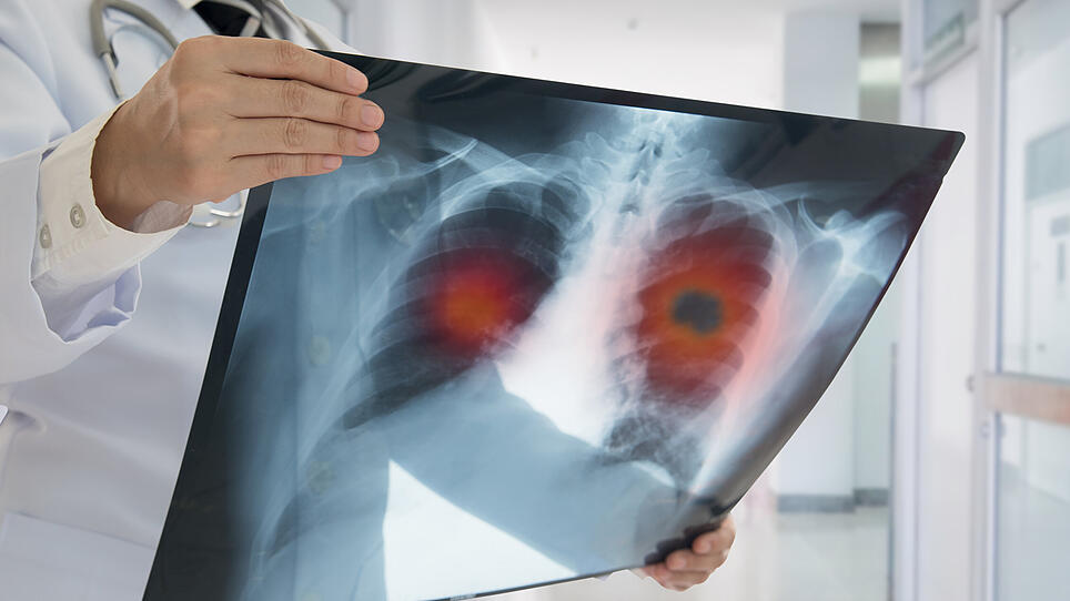 Lungenkrebs: Online-Infos für Betroffene