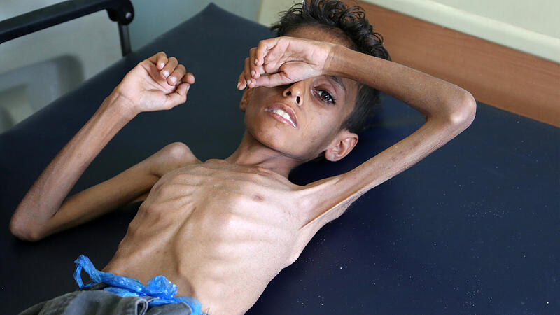 400.000 Kinder vor Hungertod, doch die Hilfsgelder für Jemen bleiben aus