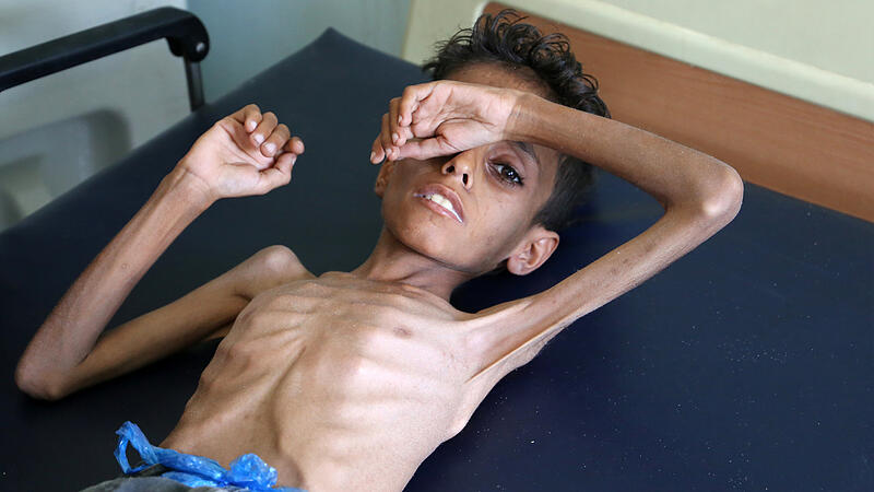 Jemen: Sieben Millionen Kinder vor dem Hungertod