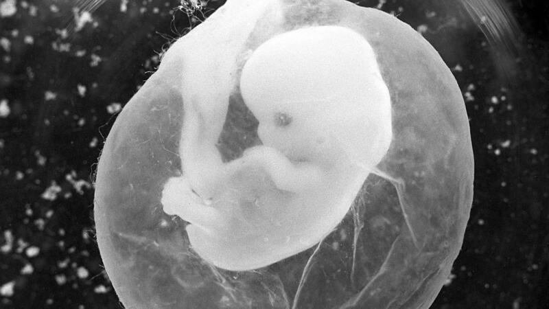 USA: 25-Jährige trug 24 Jahre alten Embryo aus
