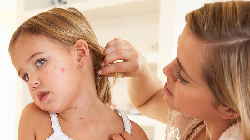 Confirmed case of measles now also in Vorarlberg