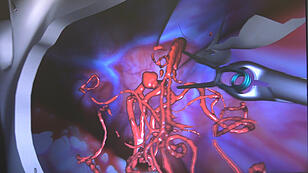 Neurochirurgischer Simulator