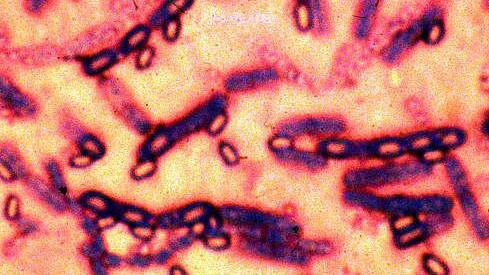 Panne der US-Armee mit gefährlicher Anthrax-Probe