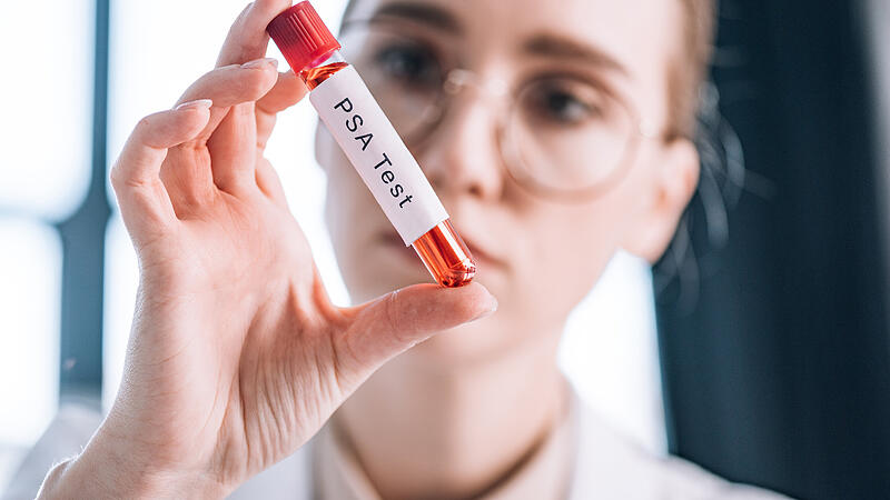 selective focus of attractive immunologist in glasses looking at test tube with psa test letters