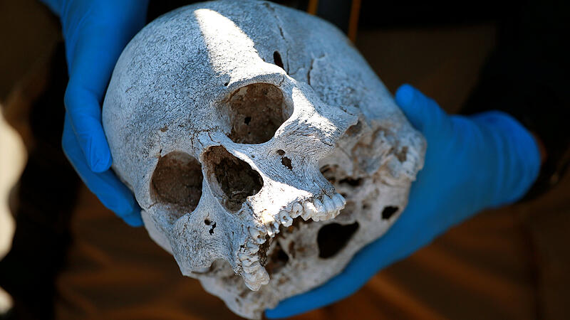 A forensic technician holds a human skull found during a search for clandestine graves in the municipality of Guadalupe