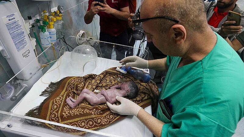 Doctors remove baby from dying mother’s womb in Gaza